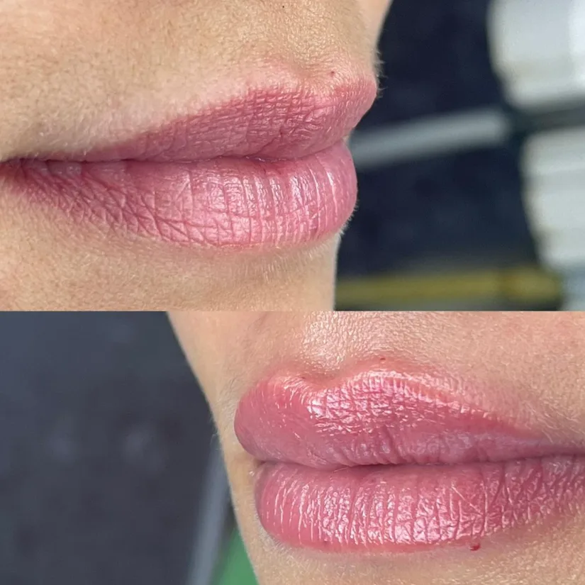 Antes y después 3