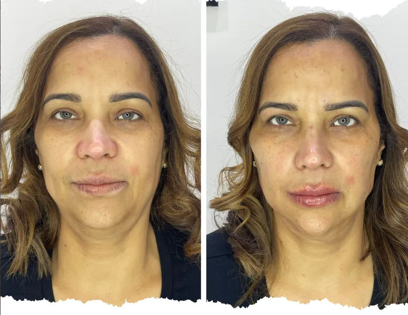 Antes y después 4