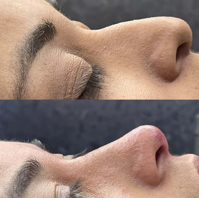 Antes y después 5