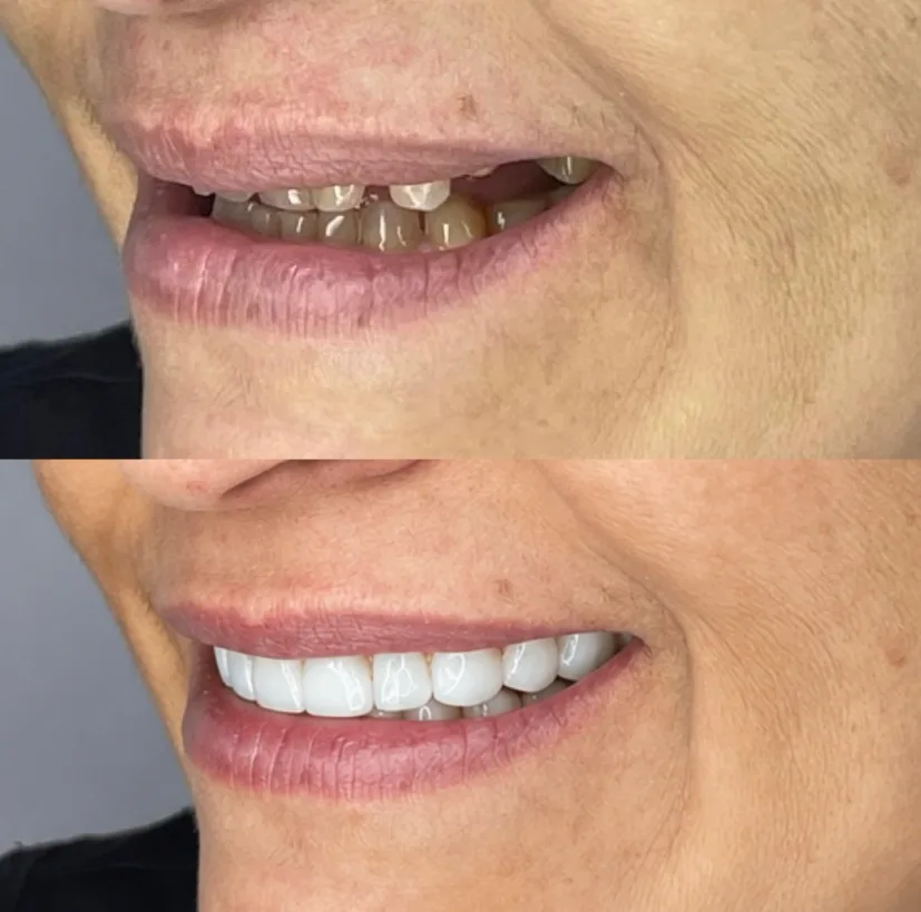 Antes y después 8